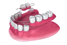 dental partials mcdonough ga - cosmetic dentistry henry county